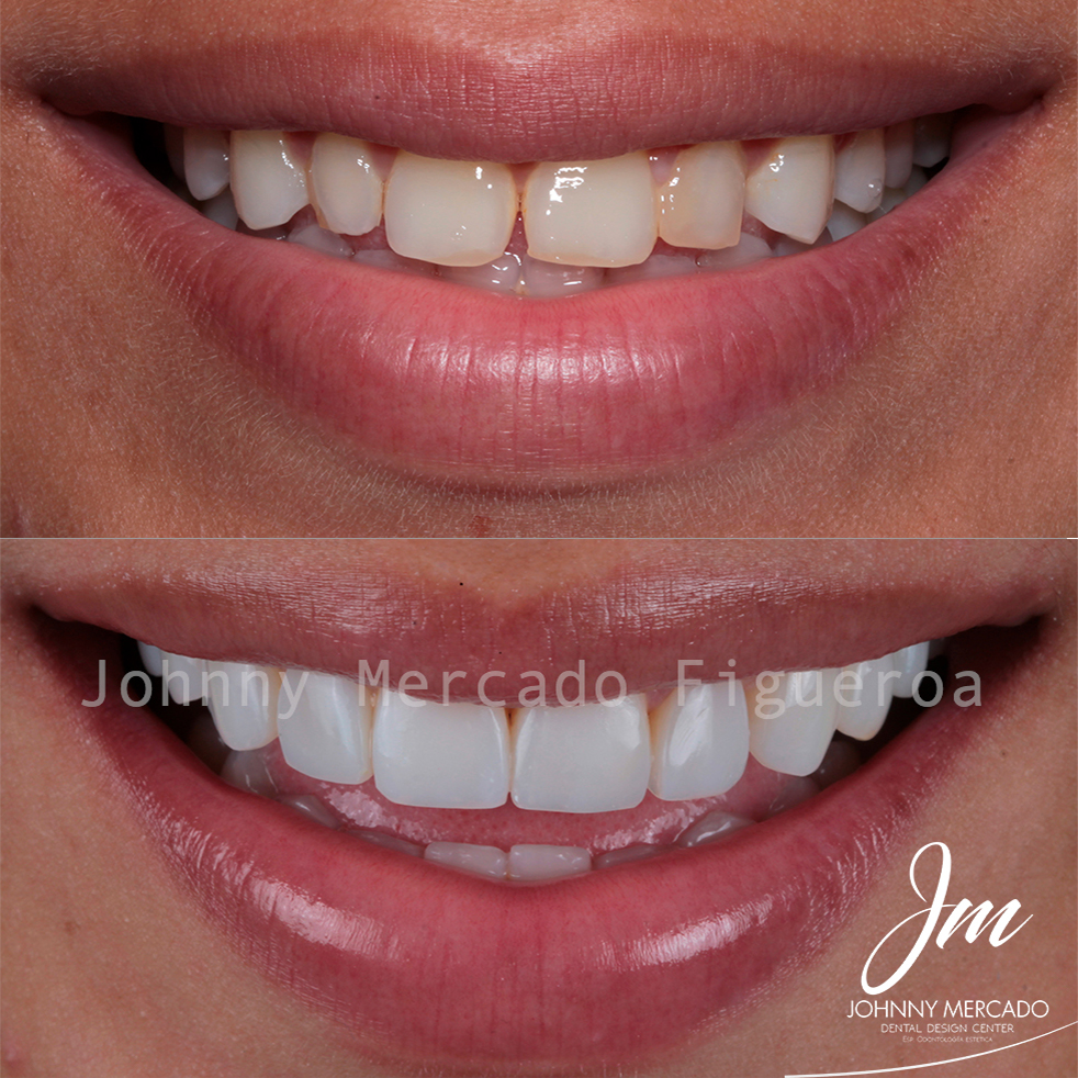 JM Dental Design Center en Bocagrande
